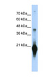 C17orf49 Antibody - C17orf49 antibody Western blot of Transfected 293T cell lysate. This image was taken for the unconjugated form of this product. Other forms have not been tested.