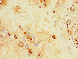 C17orf58 Antibody - Immunohistochemistry of paraffin-embedded human placenta tissue using C17orf58 Antibody at dilution of 1:100