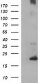 C17orf62 Antibody - HEK293T cells were transfected with the pCMV6-ENTRY control (Left lane) or pCMV6-ENTRY C17orf62 (Right lane) cDNA for 48 hrs and lysed. Equivalent amounts of cell lysates (5 ug per lane) were separated by SDS-PAGE and immunoblotted with anti-C17orf62.
