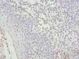 C17orf62 Antibody - Immunohistochemistry of paraffin-embedded human tonsil tissue using antibody at dilution of 1:100.