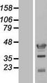 C17orf75 Protein - Western validation with an anti-DDK antibody * L: Control HEK293 lysate R: Over-expression lysate