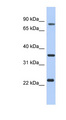 C17orf82 Antibody - C17orf82 antibody Western blot of LN18 cell lysate. This image was taken for the unconjugated form of this product. Other forms have not been tested.