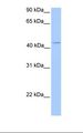C17orf97 Antibody - Jurkat cell lysate. Antibody concentration: 1.0 ug/ml. Gel concentration: 12%.  This image was taken for the unconjugated form of this product. Other forms have not been tested.