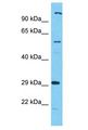 C17orf99 Antibody - C17orf99 antibody Western Blot of HeLa. Antibody dilution: 1 ug/ml.  This image was taken for the unconjugated form of this product. Other forms have not been tested.