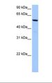 C18orf54 Antibody - Hela cell lysate. Antibody concentration: 1.0 ug/ml. Gel concentration: 12%.  This image was taken for the unconjugated form of this product. Other forms have not been tested.