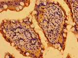 C19orf12 Antibody - Immunohistochemistry image of paraffin-embedded human small intestine tissue at a dilution of 1:100