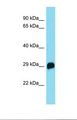 C19orf22 Antibody - Western blot of Mouse Kidney. R3hdm4 antibody dilution 1.0 ug/ml.  This image was taken for the unconjugated form of this product. Other forms have not been tested.