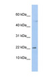 C19orf25 Antibody - C19orf25 antibody Western blot of OVCAR-3 cell lysate. This image was taken for the unconjugated form of this product. Other forms have not been tested.