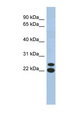 C19orf54 Antibody - C19orf54 antibody Western blot of Fetal Muscle lysate. This image was taken for the unconjugated form of this product. Other forms have not been tested.