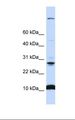 C19orf56 Antibody - 721_B cell lysate. Antibody concentration: 1.0 ug/ml. Gel concentration: 10-20%.  This image was taken for the unconjugated form of this product. Other forms have not been tested.