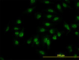 C1D Antibody - Immunofluorescence of monoclonal antibody to C1D on HeLa cell. [antibody concentration 10 ug/ml]