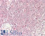 C1GALT1 Antibody - Human Spleen: Formalin-Fixed, Paraffin-Embedded (FFPE)