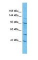 C1orf101 Antibody - Western blot of CA101 Antibody with human A549 Whole Cell lysate.  This image was taken for the unconjugated form of this product. Other forms have not been tested.