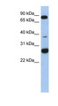 C1orf110 Antibody - C1orf110 antibody Western blot of Fetal Heart lysate. This image was taken for the unconjugated form of this product. Other forms have not been tested.
