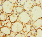 C1orf112 Antibody - Immunohistochemistry of paraffin-embedded human thyroid tissue using C1orf112 Antibody at dilution of 1:100