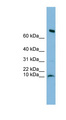 C1orf122 Antibody - C1orf122 antibody Western blot of Fetal Heart lysate. This image was taken for the unconjugated form of this product. Other forms have not been tested.
