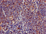C1orf177 Antibody - Immunohistochemistry of paraffin-embedded human lymph node tissue using LEXM Antibody at dilution of 1:100