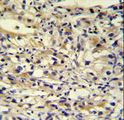 C1orf186 Antibody - C1orf186 antibody immunohistochemistry of formalin-fixed and paraffin-embedded human kidney tissue followed by peroxidase-conjugated secondary antibody and DAB staining.