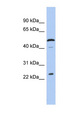 C1orf190 Antibody - C1orf190 antibody Western blot of Jurkat lysate. This image was taken for the unconjugated form of this product. Other forms have not been tested.