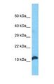 C1orf21 Antibody - Western blot of C1orf21 Antibody with human 293T Whole Cell lysate.  This image was taken for the unconjugated form of this product. Other forms have not been tested.