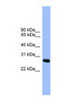 C1orf216 Antibody - C1orf216 antibody Western blot of MCF7 cell lysate. This image was taken for the unconjugated form of this product. Other forms have not been tested.