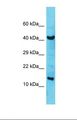 C1orf31 Antibody - Western blot of Human MCF7. COA6 antibody dilution 1.0 ug/ml.  This image was taken for the unconjugated form of this product. Other forms have not been tested.