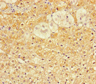 C1orf31 Antibody - Immunohistochemistry of paraffin-embedded human adrenal gland tissue using COA6 Antibody at dilution of 1:100