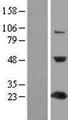 C1orf50 Protein - Western validation with an anti-DDK antibody * L: Control HEK293 lysate R: Over-expression lysate