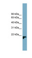 C1orf93 Antibody - C1orf93 antibody Western blot of PANC1 cell lysate. This image was taken for the unconjugated form of this product. Other forms have not been tested.