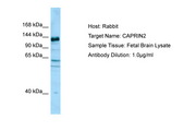 C1QDC1 / Caprin-2 Antibody -  This image was taken for the unconjugated form of this product. Other forms have not been tested.