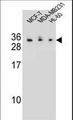 C1QL4 Antibody - C1QL4 Antibody western blot of MCF-7,MDA-MB231,HL-60 cell line lysates (35 ug/lane). The C1QL4 antibody detected the C1QL4 protein (arrow).