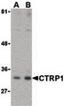 C1QTNF1 / CTRP1 Antibody - Western blot of CTRP1 in MDA-MD-361 cell lysate with CTRP1 (IN) antibody at (A) 1 and (B) 2 ug/ml.