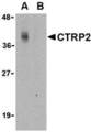 C1QTNF2 / CTRP2 Antibody - Western blot of CTRP2 in Caco-2 cell lysate with CTRP2 antibody at 1 ug/ml in either the (A) absence or (B) presence of blocking peptide.