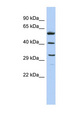 C1QTNF7 / CTRP7 Antibody - C1QTNF7 / CTRP7 antibody Western blot of COLO205 cell lysate. This image was taken for the unconjugated form of this product. Other forms have not been tested.