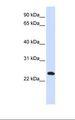 C20orf103 Antibody - 721_B cell lysate. Antibody concentration: 1.0 ug/ml. Gel concentration: 12%.  This image was taken for the unconjugated form of this product. Other forms have not been tested.