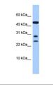 C20orf141 Antibody - Hela cell lysate. Antibody concentration: 1.0 ug/ml. Gel concentration: 10-20%.  This image was taken for the unconjugated form of this product. Other forms have not been tested.