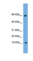 C20orf144 Antibody - C20orf144 antibody Western blot of NCI-H226 cell lysate. This image was taken for the unconjugated form of this product. Other forms have not been tested.
