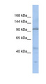 C20orf194 Antibody - C20orf194 antibody Western blot of SH-SYSY lysate. This image was taken for the unconjugated form of this product. Other forms have not been tested.
