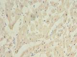 C20orf27 Antibody - Immunohistochemistry of paraffin-embedded human heart tissue using antibody at dilution of 1:100.