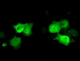 C21orf59 Antibody - Anti-C21orf59 mouse monoclonal antibody  immunofluorescent staining of COS7 cells transiently transfected by pCMV6-ENTRY C21orf59.