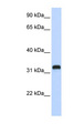 C21orf62 Antibody - C21orf62 antibody Western blot of 293T cell lysate. This image was taken for the unconjugated form of this product. Other forms have not been tested.