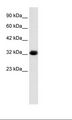 C22orf31 Antibody - HepG2 Cell Lysate.  This image was taken for the unconjugated form of this product. Other forms have not been tested.