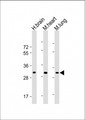 C25H / CH25H Antibody - All lanes: Anti-CH25H Antibody (N-Term) at 1:1000-1:2000 dilution Lane 1: Human brain lysate Lane 2: Mouse heart lysate Lane 3: Mouse lung lysate Lysates/proteins at 20 µg per lane. Secondary Goat Anti-Rabbit IgG, (H+L), Peroxidase conjugated at 1/10000 dilution. Predicted band size: 32 kDa Blocking/Dilution buffer: 5% NFDM/TBST.