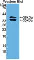 C2CD3 Antibody - Western Blot; Sample: Recombinant protein.