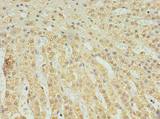 C2orf15 Antibody - Immunohistochemistry of paraffin-embedded human adrenal gland tissue using antibody at dilution of 1:100.