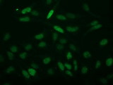 C2orf40 / ECRG4 Antibody - Immunofluorescent staining of HeLa cells using anti-C2orf40 mouse monoclonal antibody.
