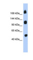 C2orf55 Antibody - C2orf55 antibody Western blot of Placenta lysate. This image was taken for the unconjugated form of this product. Other forms have not been tested.