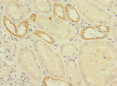 C2orf76 Antibody - Immunohistochemistry of paraffin-embedded human kidney tissue using C2orf76 Antibody at dilution of 1:100