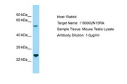 C3orf58 Antibody -  This image was taken for the unconjugated form of this product. Other forms have not been tested.