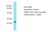 C4orf45 Antibody -  This image was taken for the unconjugated form of this product. Other forms have not been tested.